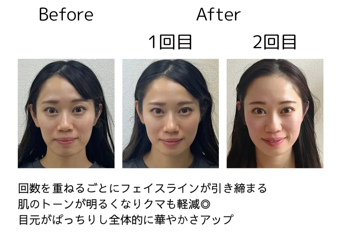 鍼灸師 NARUMIのエステ・リラクイメージ