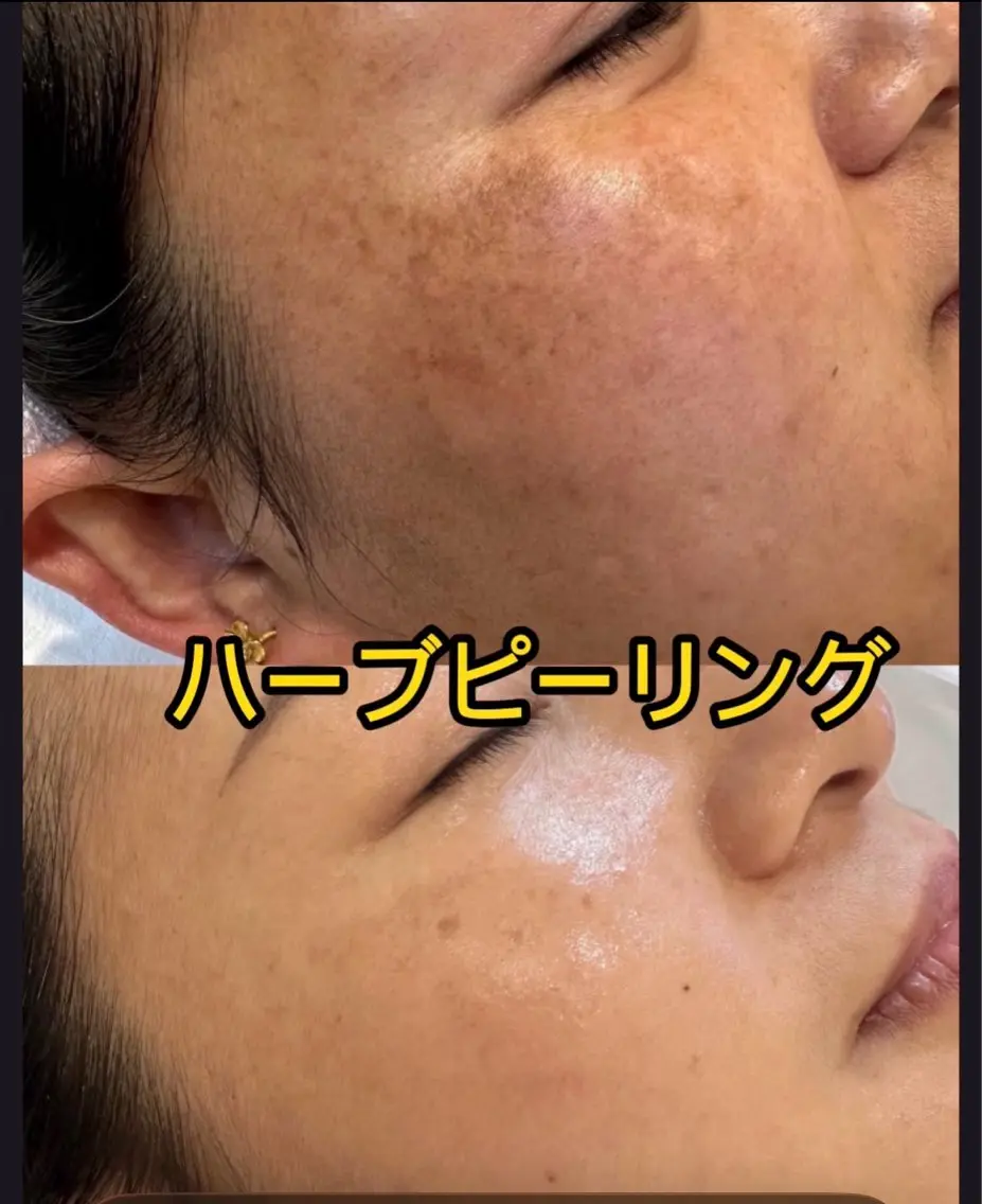 エステ JUNA 健康美サロン渋谷店のエステ・リラクイメージ