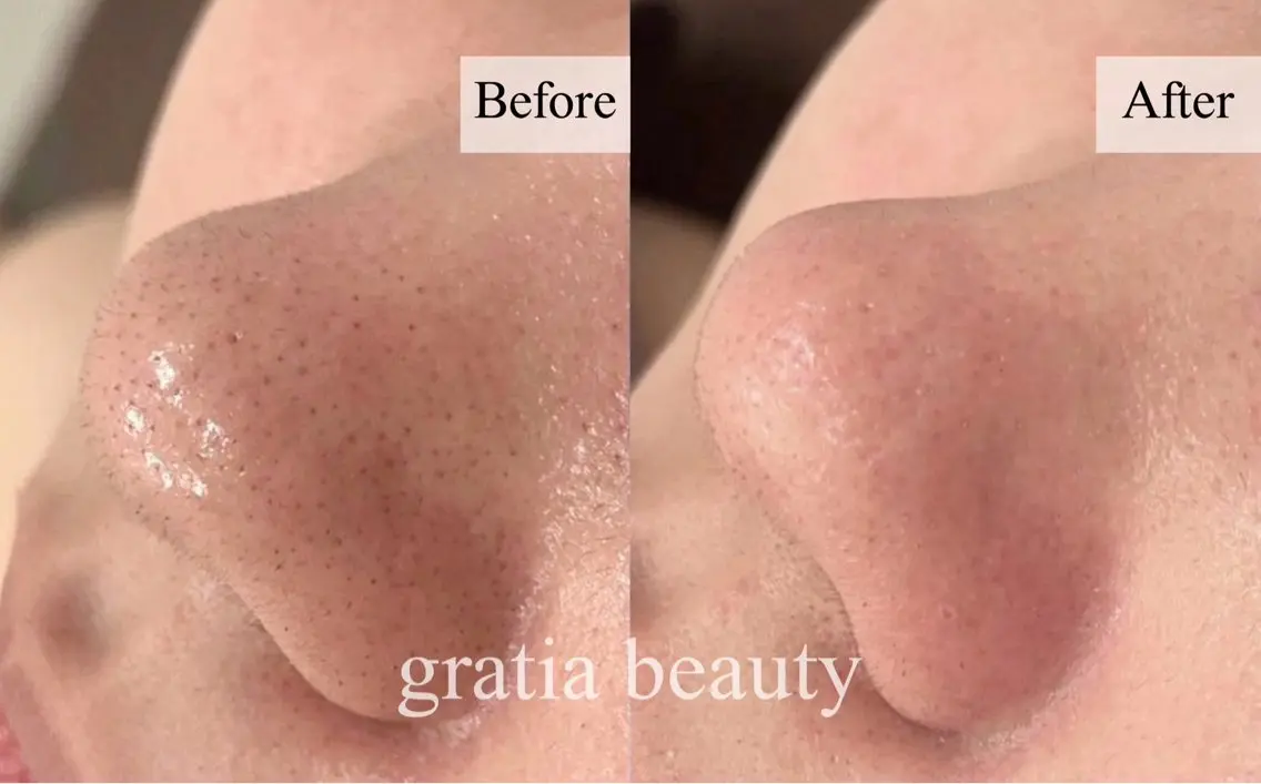 エステ gratia salonのエステ・リラクイメージ