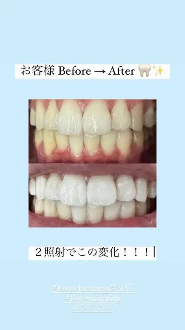 ラブホワイトニング 池袋店 ヒカルのエステ・リラクイメージ