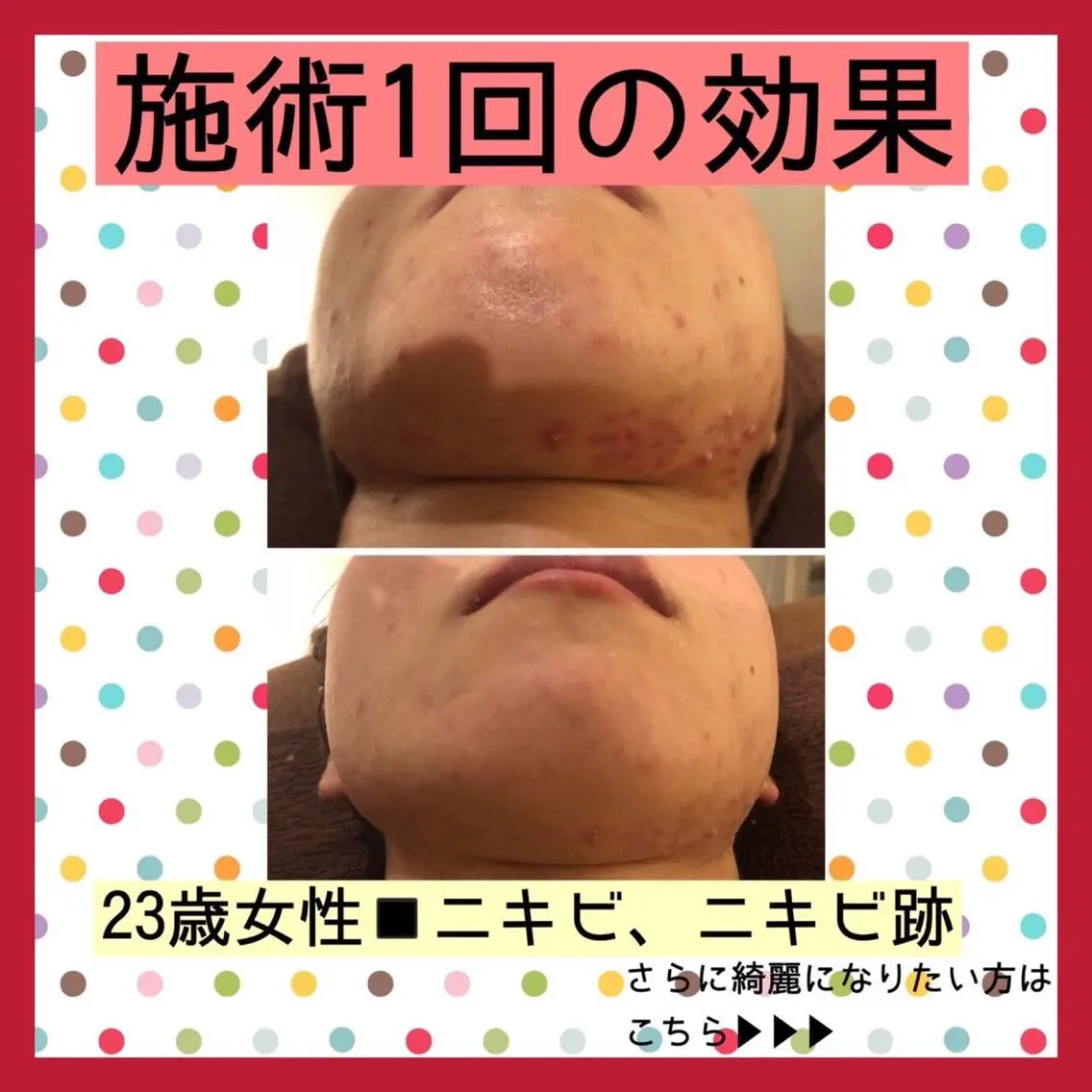 ミディアム パーマ ヘアアレンジ メンズ キッズ ネイル マツエク・マツパ エステ リラク ニキビ・肌質改善専門 ♡人生が変わるサロンのエステ・リラクイメージ