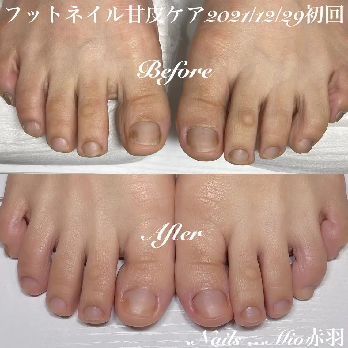 ネイル フットネイル .Nails Mio 赤羽西ネイルサロンのネイルデザイン