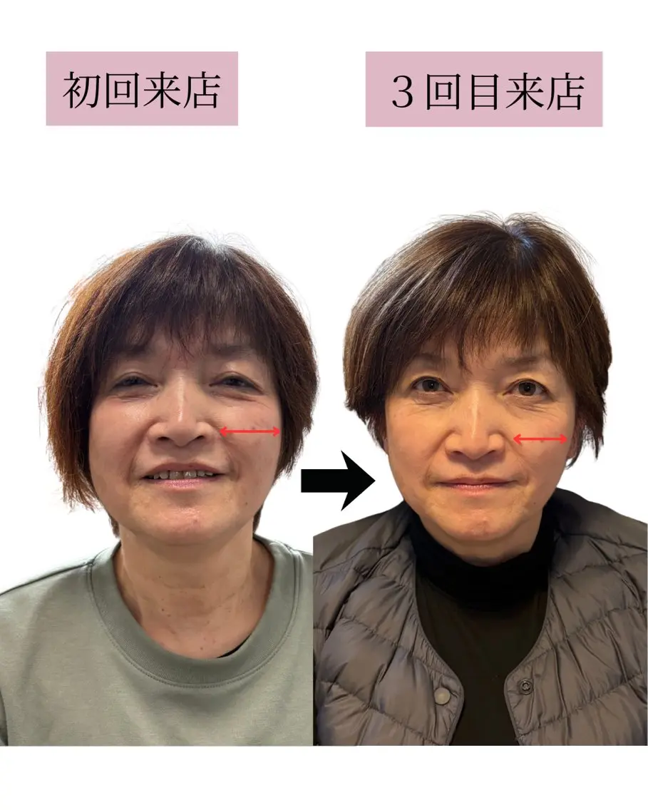 美肌&小顔矯正 Noelieのエステ・リラクイメージ