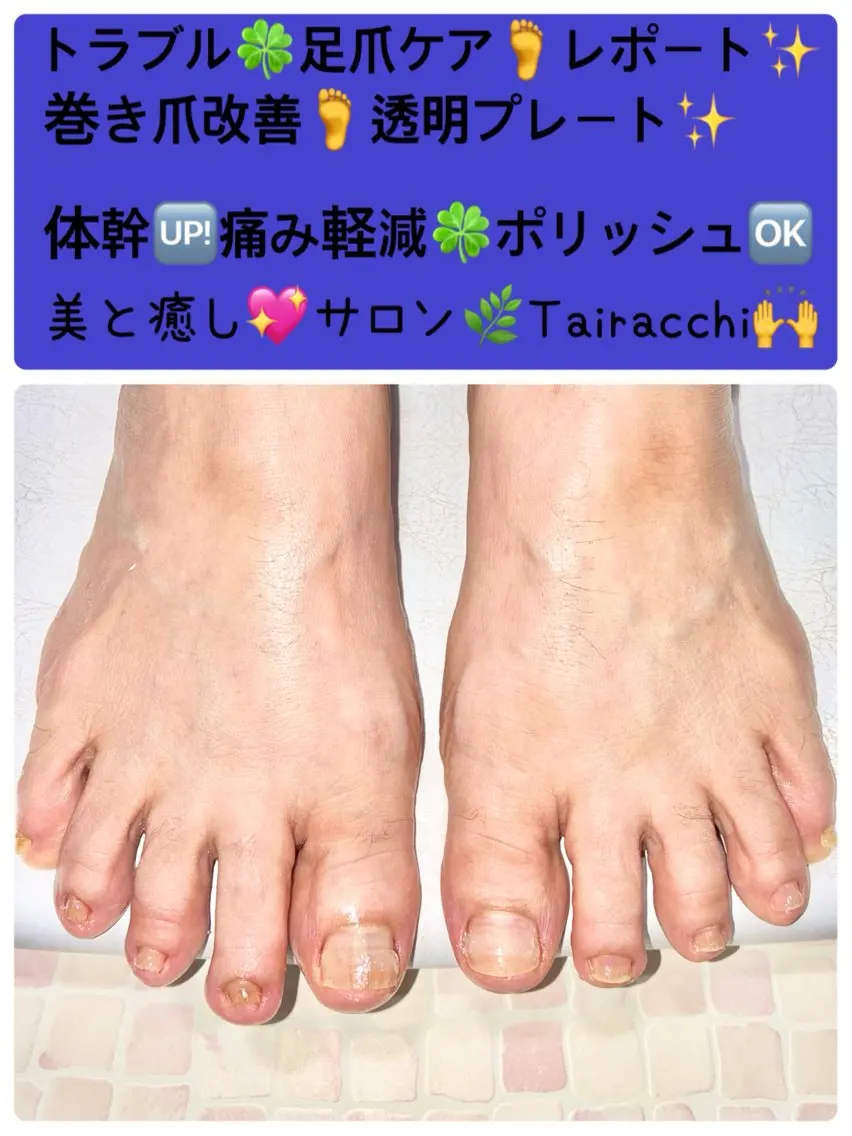 ネイル フットネイル Tairacchi ﾀｲﾗｯﾁのエステ・リラクイメージ