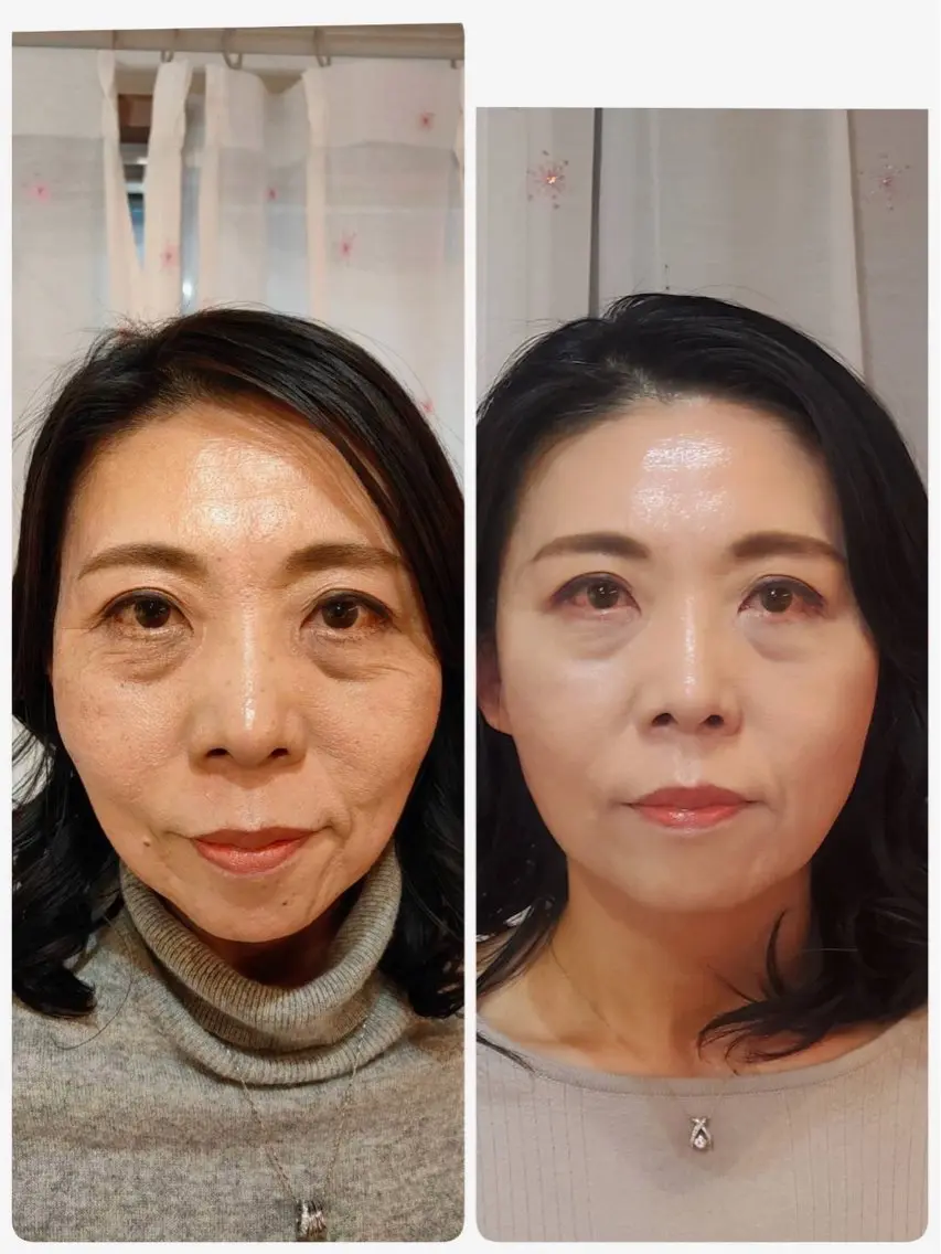 エステ ラムーン アイラッシュ&ヘアメのマツエク・マツパデザイン