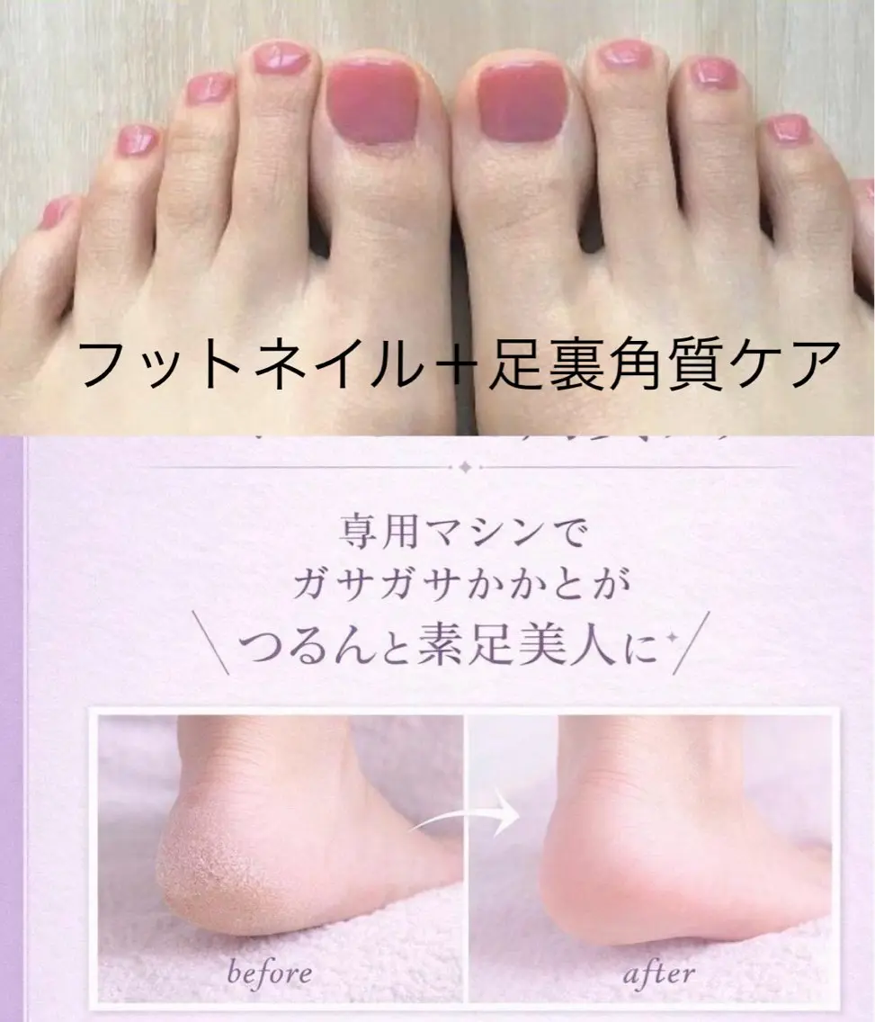 フットネイルワンカラー＋足裏角質ケアセット/専用マシーンでツルツルのかかとに♪の写真
