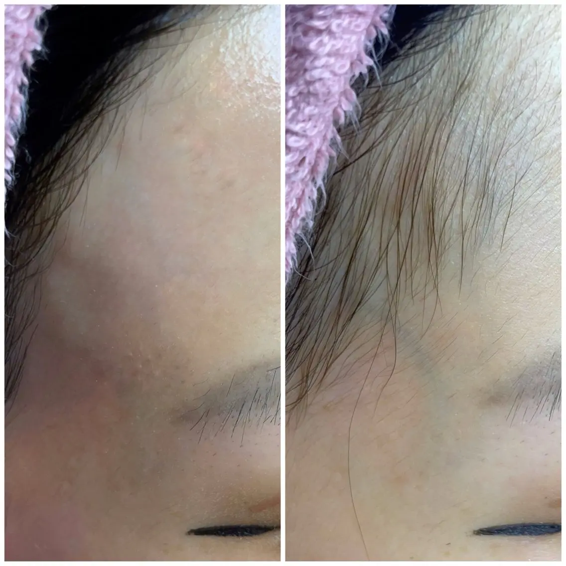 フェイシャルWaxの写真