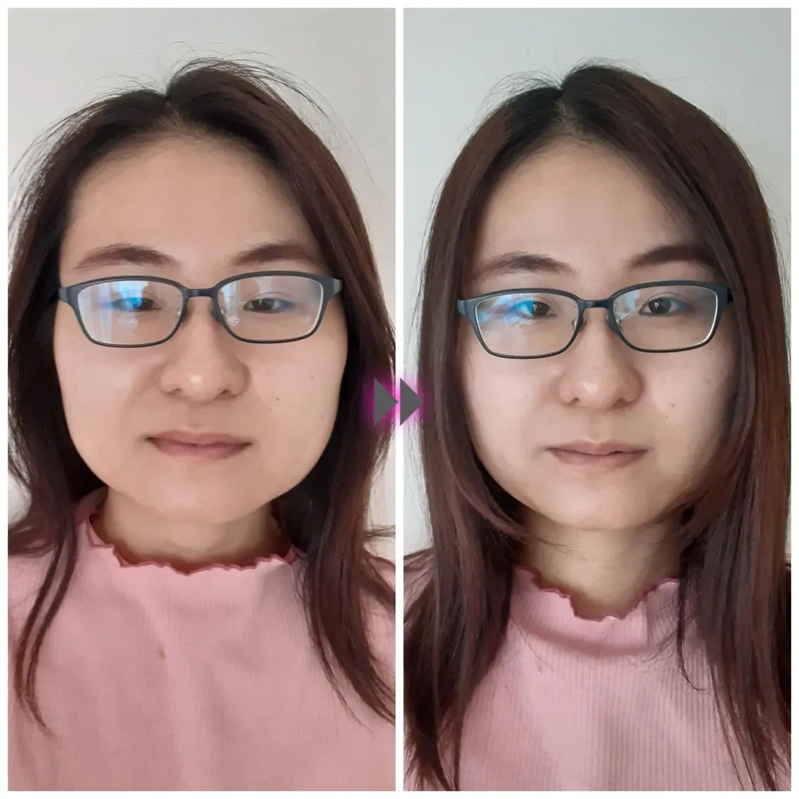 【顔の歪み│むくみ】小顔整体40分 顔の土台を調整し整えますの写真