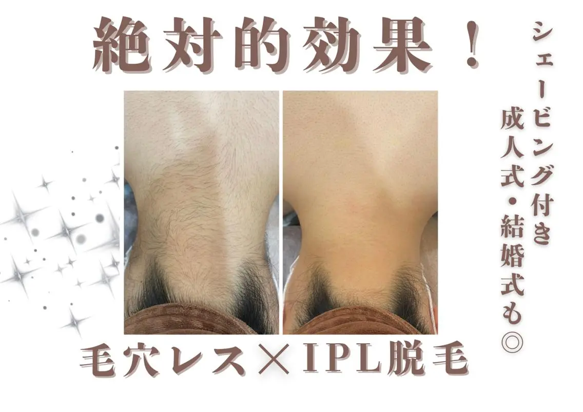 つるぴか全身脱毛🩵✨オーダーメイドで毛質チェックさせて頂きます!!の写真