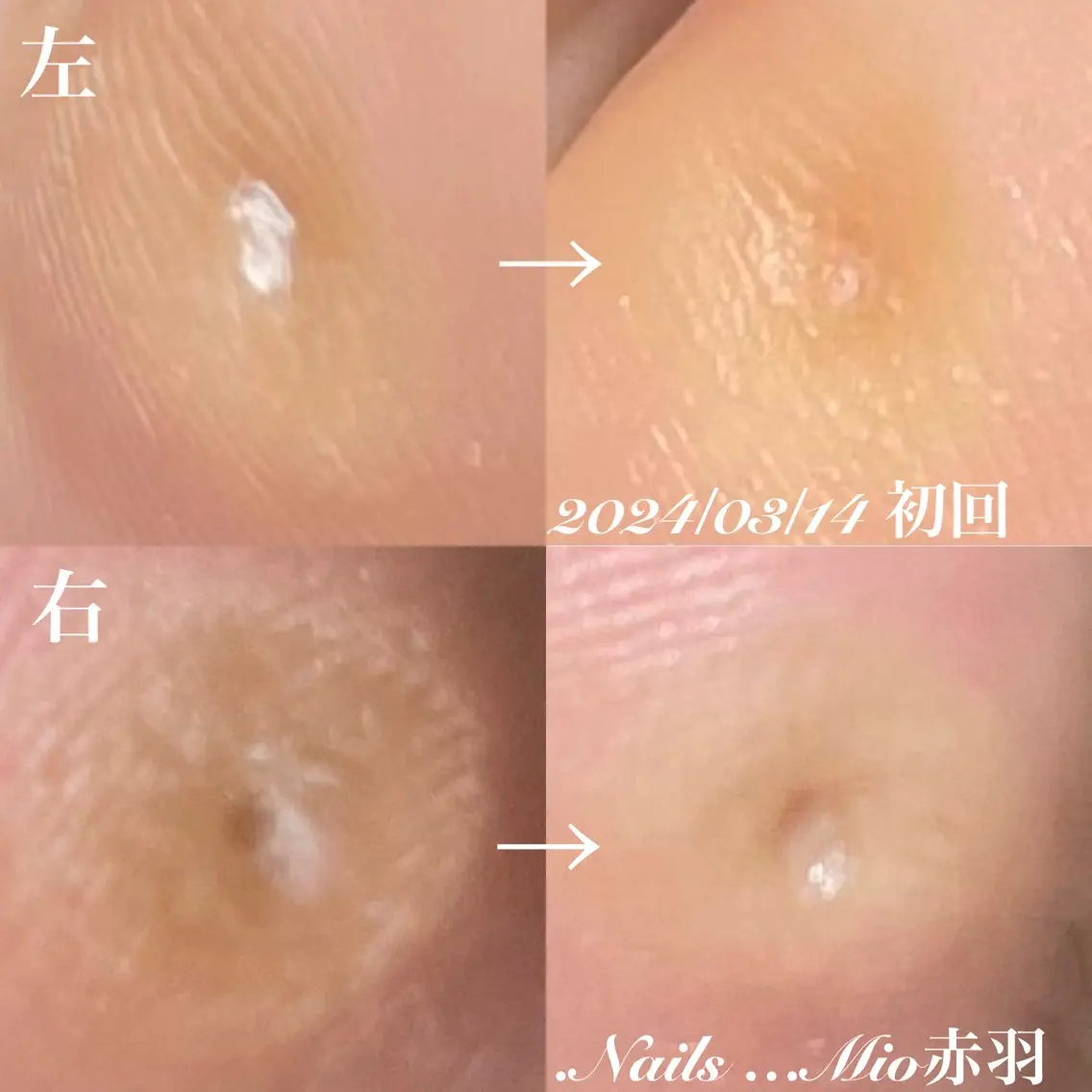 ネイル フットネイル フットネイル .Nails Mio 赤羽西ネイルサロンのネイルデザイン