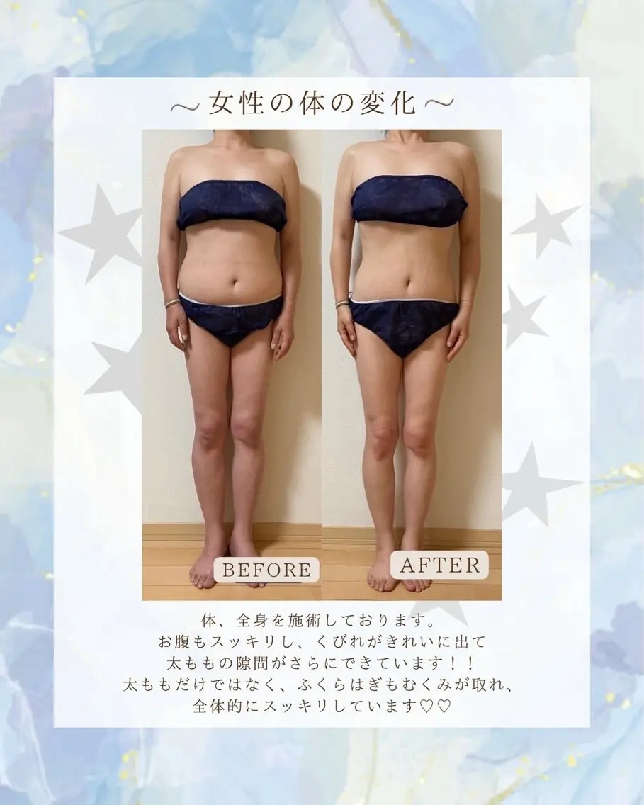 【ヒップアップ&脚のむくみケア】お尻が弛んできた、脚のむくみや冷えが気になる方におすすめです🌼🤍の写真