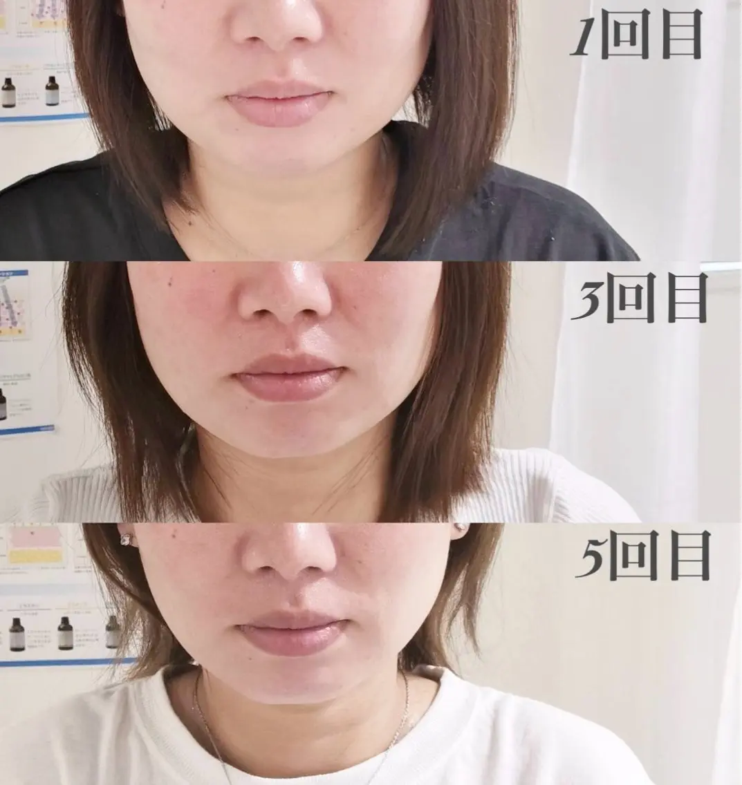 美容鍼と美肌専門 ハリステリアのエステ・リラクイメージ