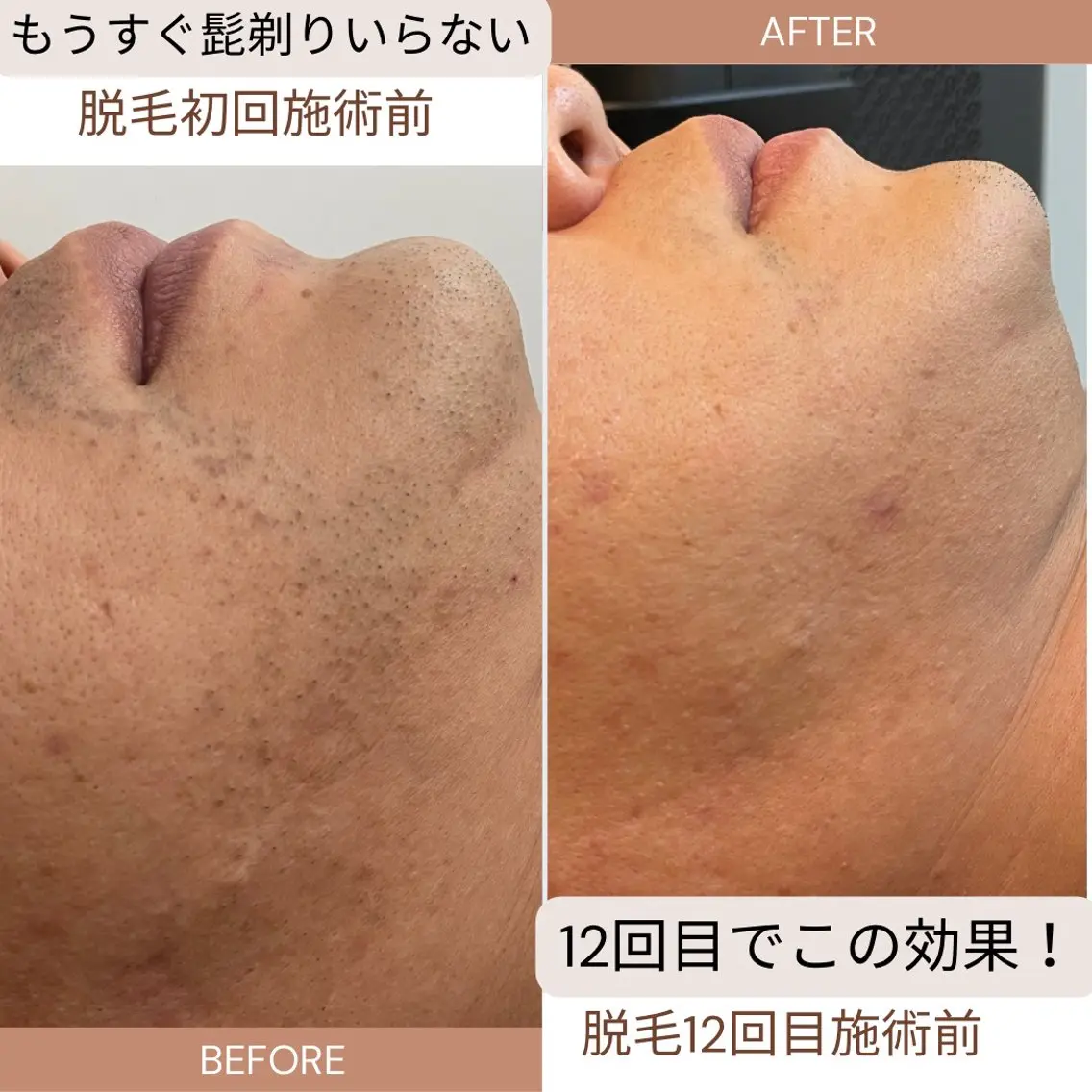 夕希 毛穴と脱毛特化サロンのエステ・リラクイメージ