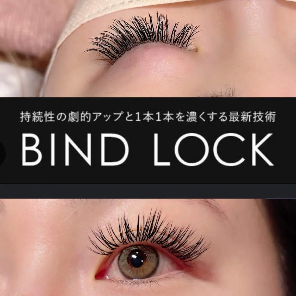 バインドロック　100本の写真