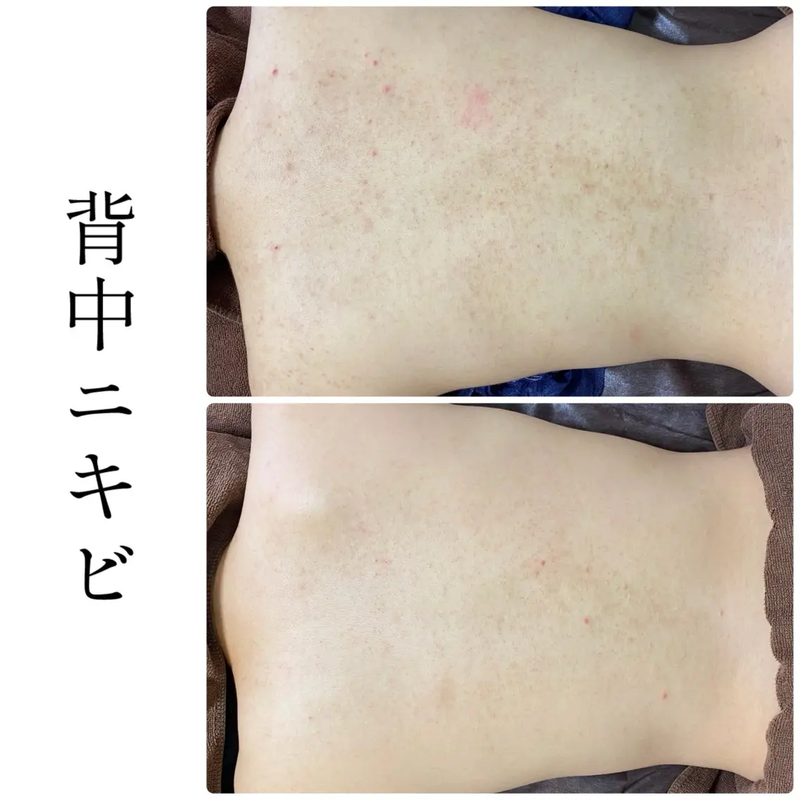 エステ ハーブピーリング専門 BIOEL横浜のエステ・リラクイメージ