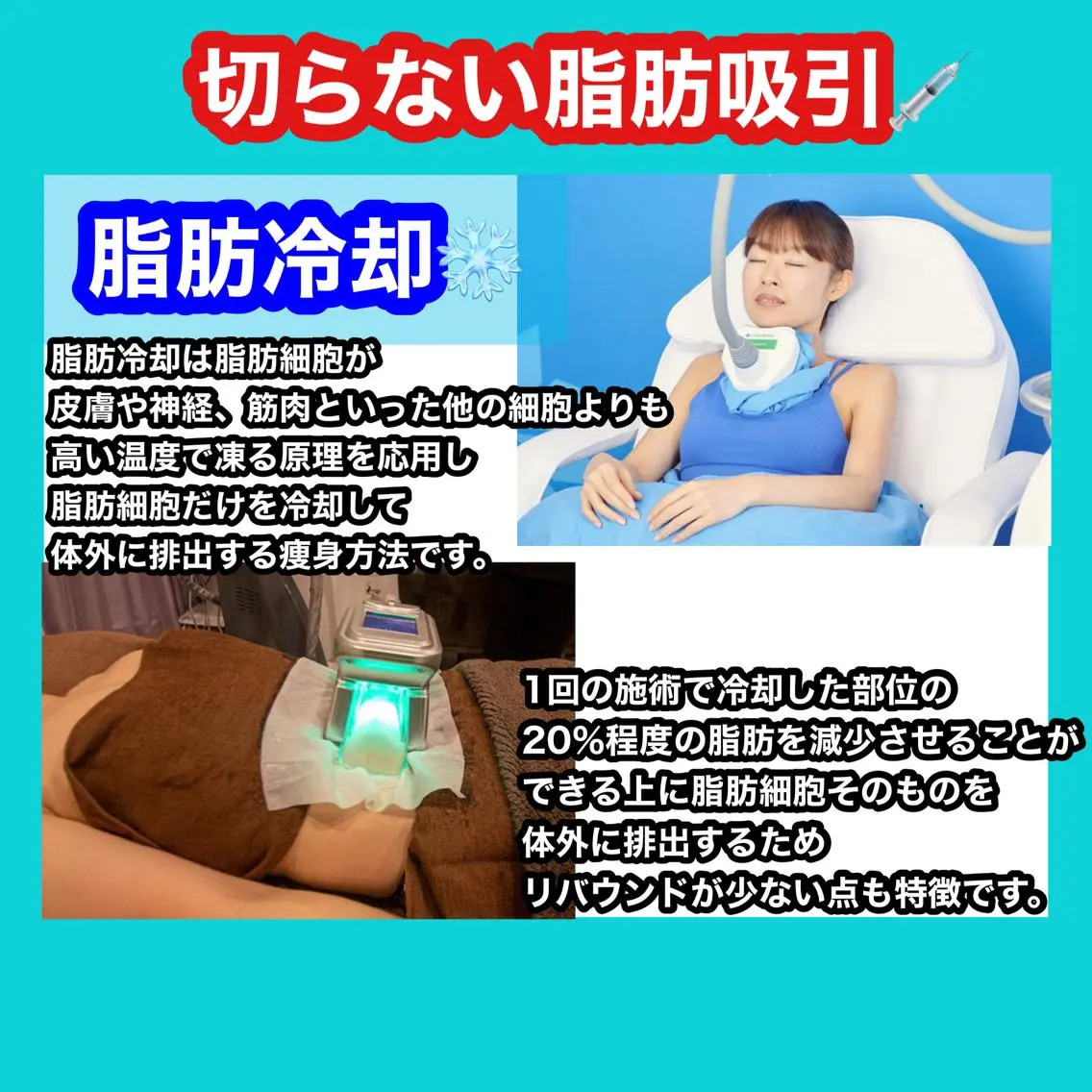 冷却マシーン❄️ 【2カップ】冷却50分+マッサージ10分【合計60分】の写真