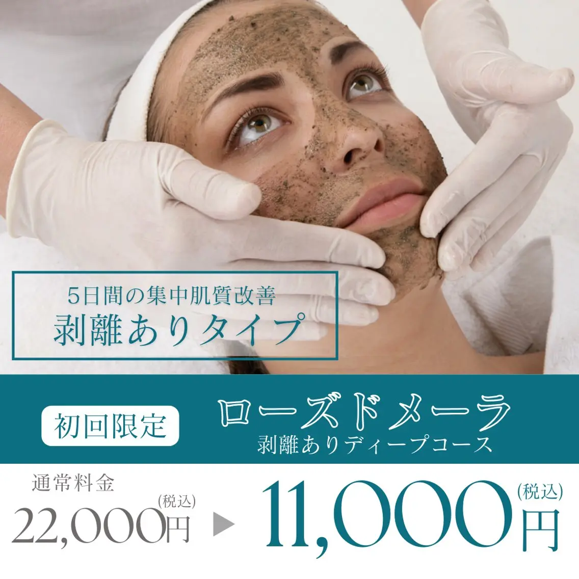 【6/12まで限定❗️】剥離ありハーブピーリング🌿5日間の本格肌質改善✨ニキビ/ニキビ跡/クレーター/シミ◎の写真