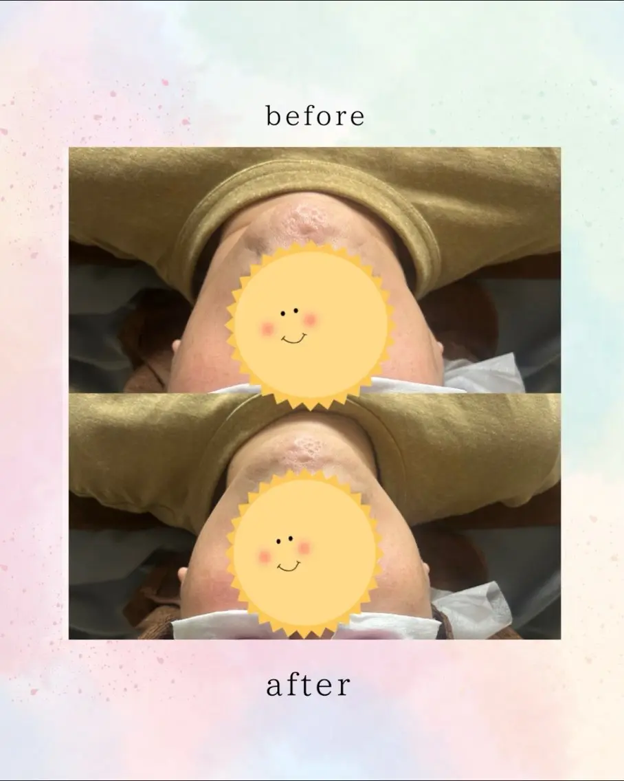 エステ Belle ＋vi（ベル）のその他イメージ