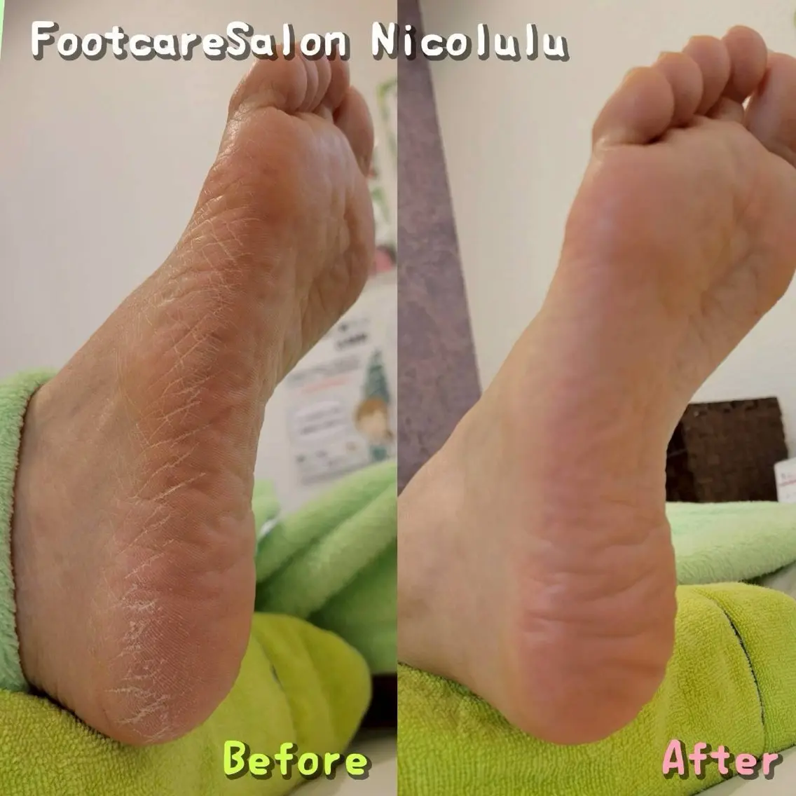 Nicolulu 金沢店のエステ・リラクイメージ