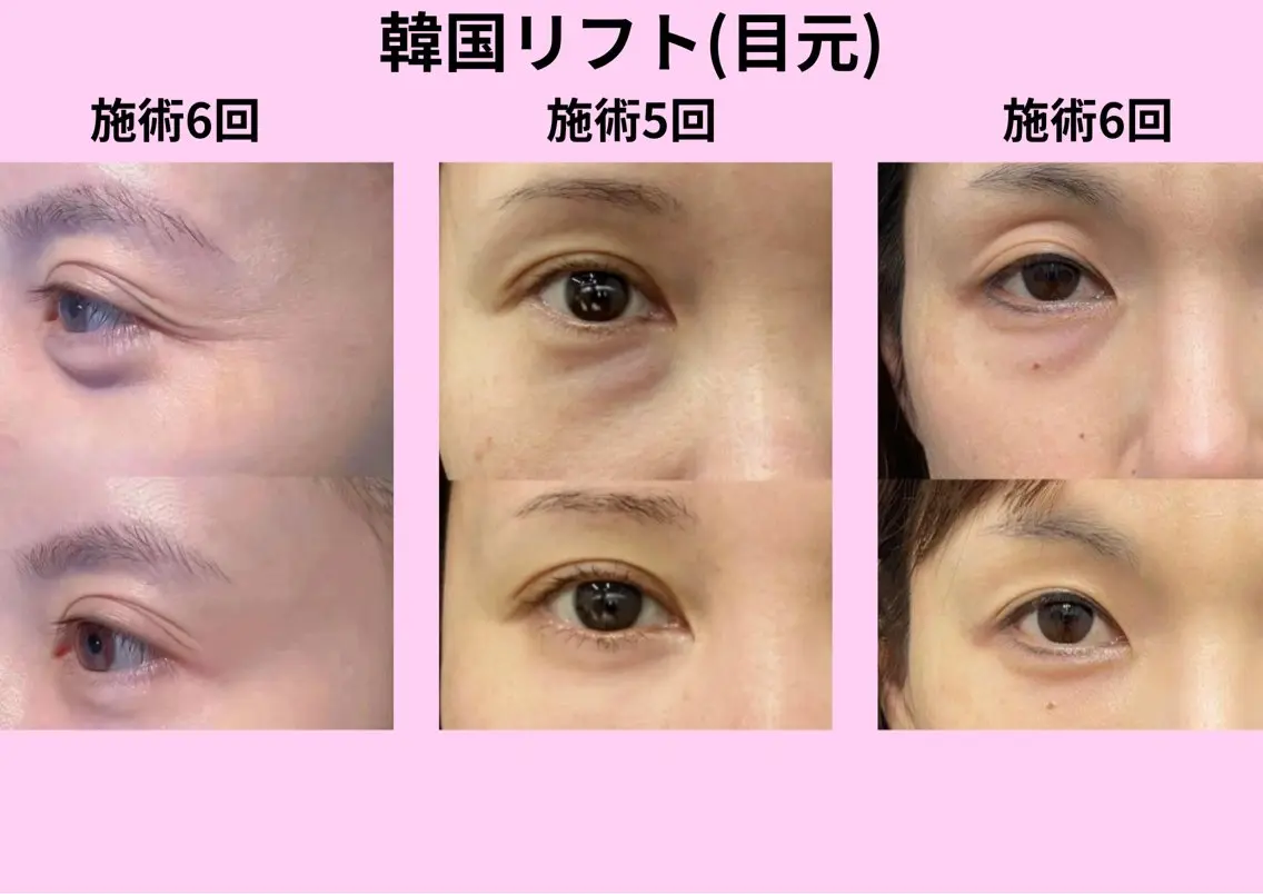 エステ リラク 愛維美水光美肌専門店 メンズレディースokのエステ・リラクイメージ