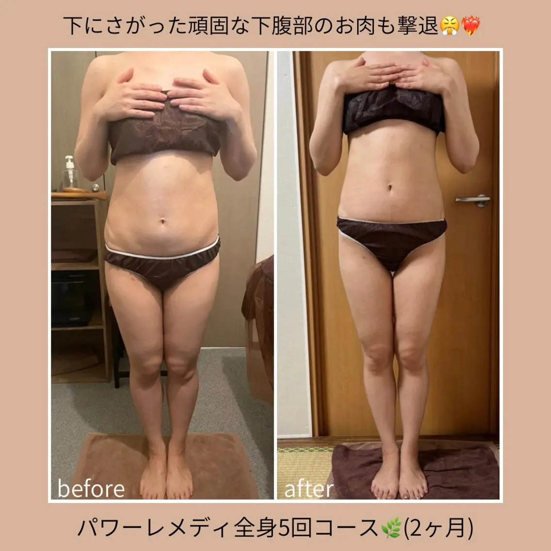《本気痩せ×疲労改善 》 BILOOPのエステ・リラクイメージ