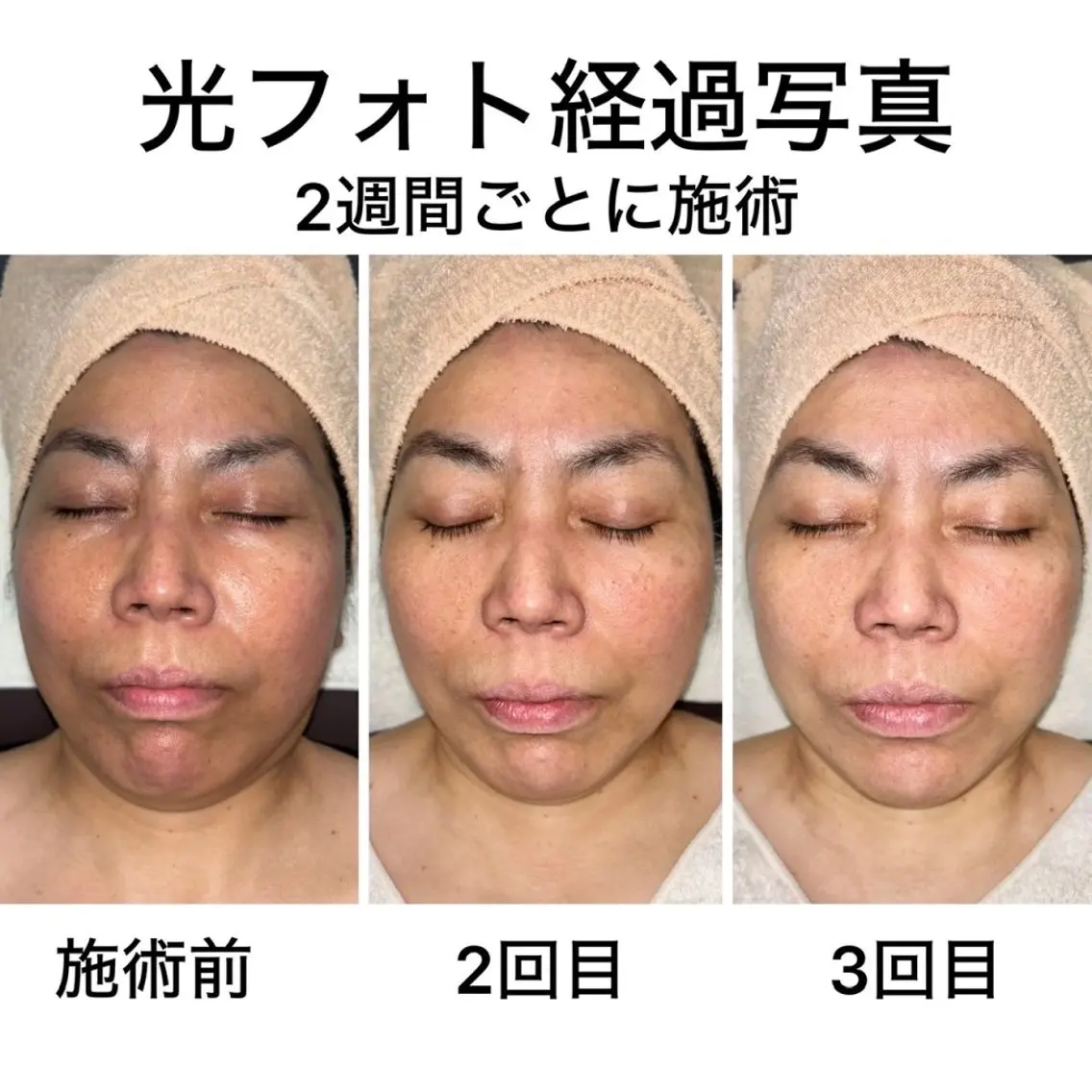 キッズ メンズ 脱毛*エステ*リラク 猫の手【丸田和可子】のエステ・リラクイメージ