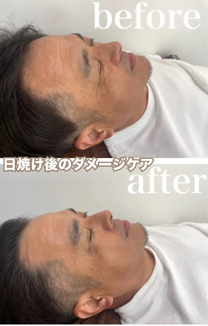 エステ リラク パーソナルスキンケア 🦋APRI🅿️有のエステ・リラクイメージ
