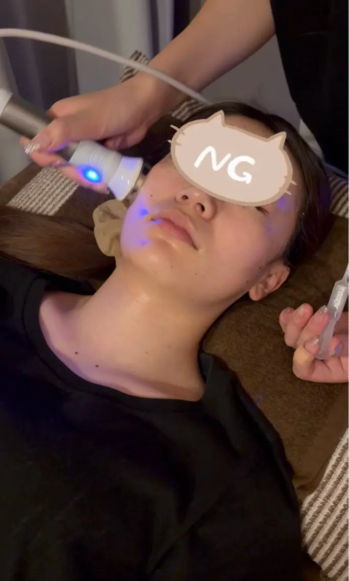 【美顔フェイスラインスッキリコース】ハイパーナイフフェイシャル＋フェイシャルマッサージの写真