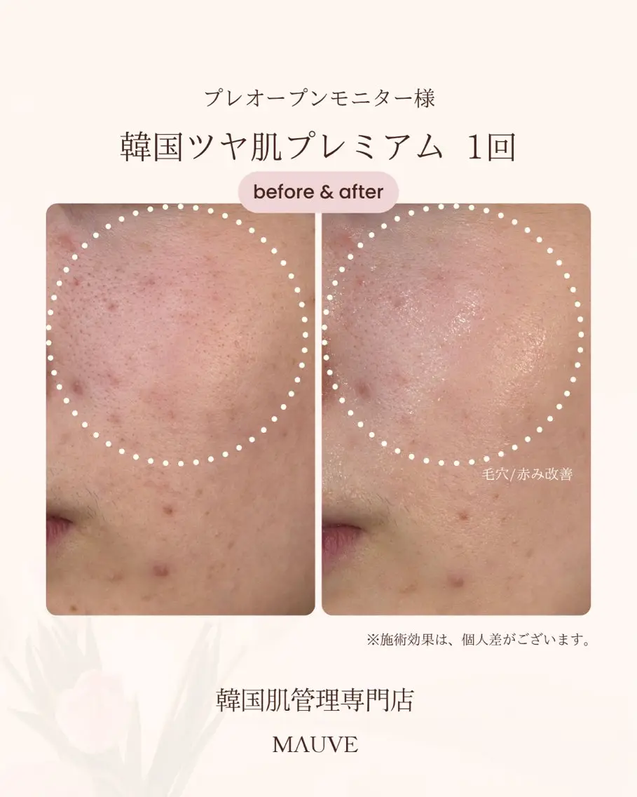エステ MAUVE minamiのエステ・リラクイメージ