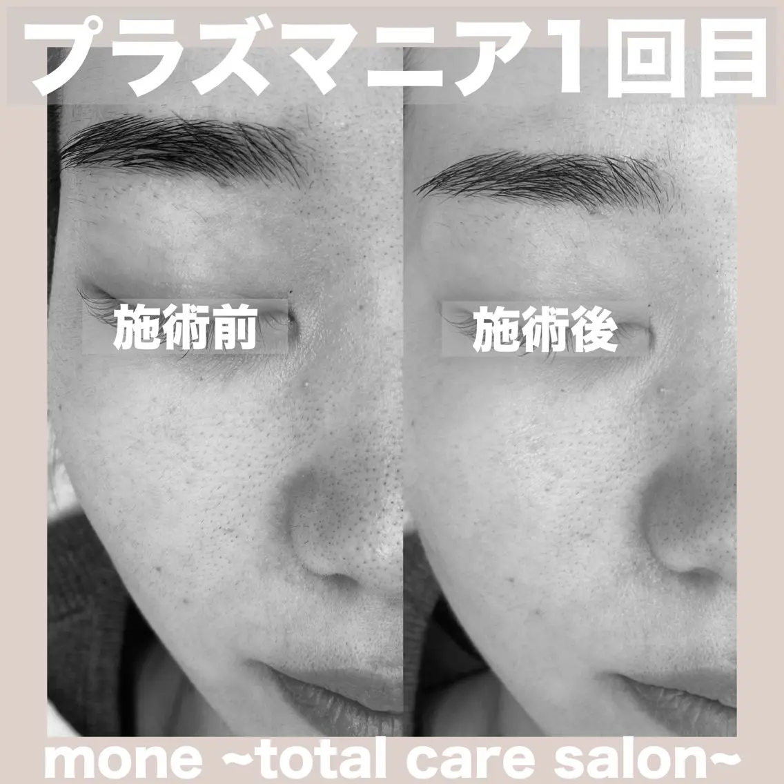 エステ mone (モーネ)のエステ・リラクイメージ