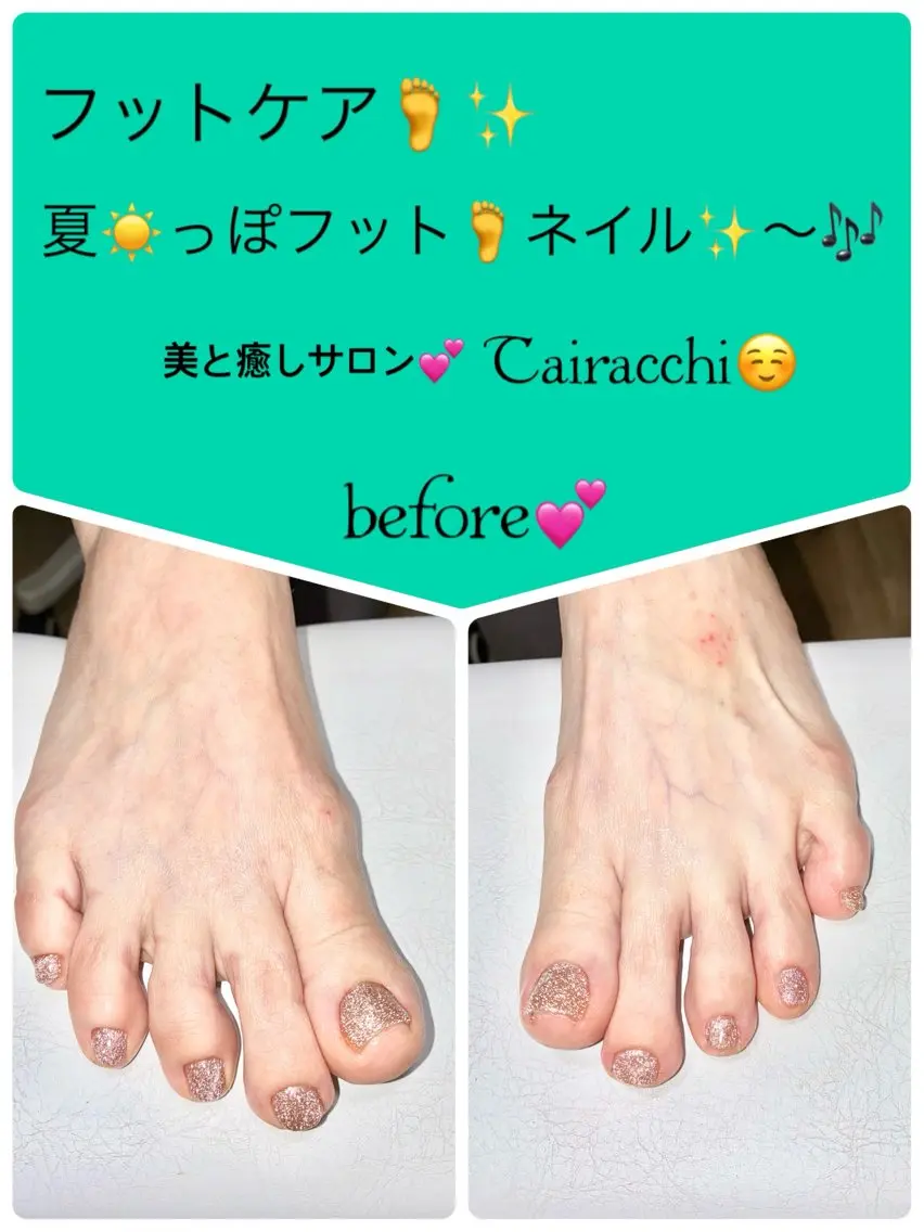 ネイル フットネイル ゴールド フットネイル Tairacchi タイラッチのエステ・リラクイメージ