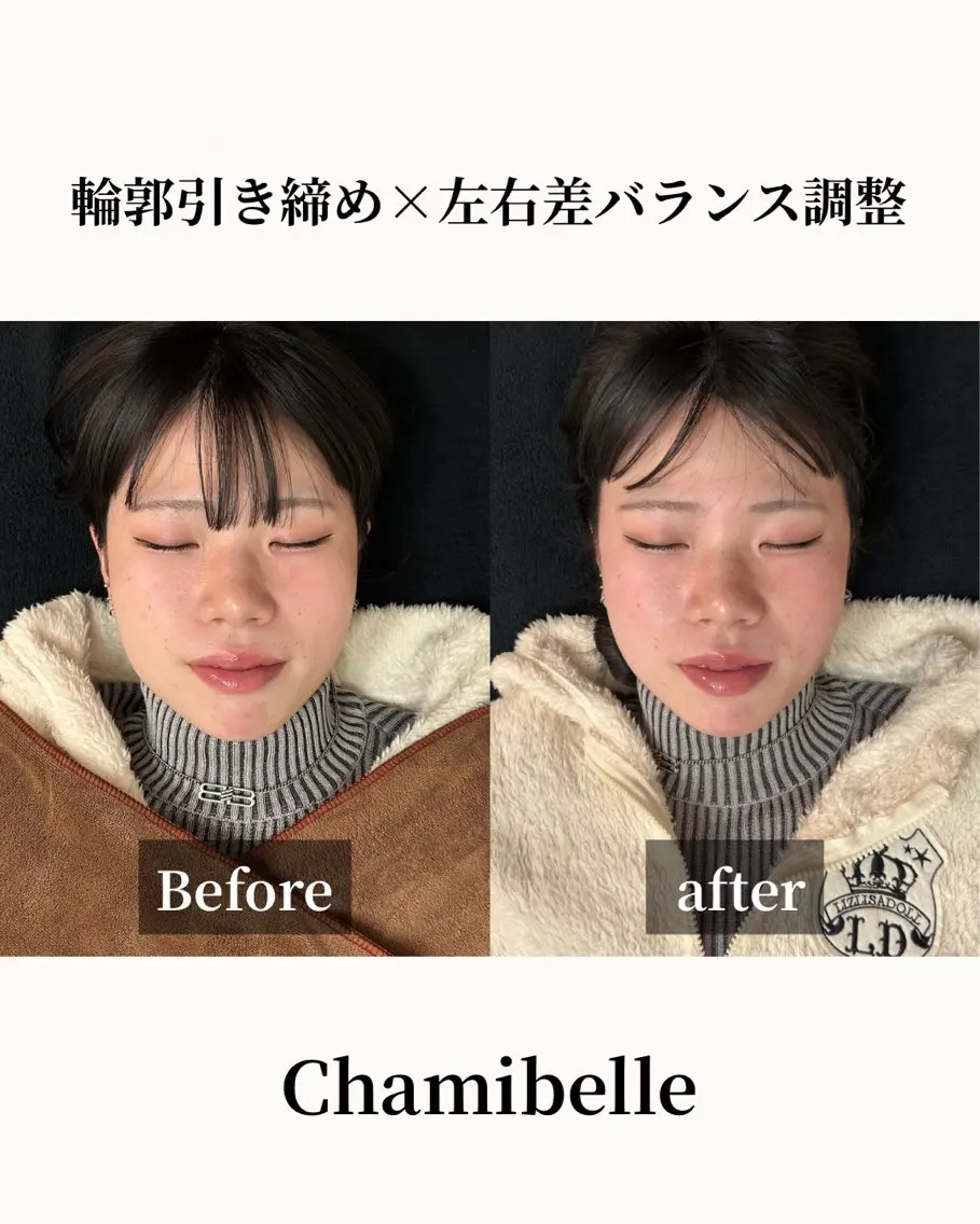 美容鍼灸サロン Chamibelleのエステ・リラクイメージ