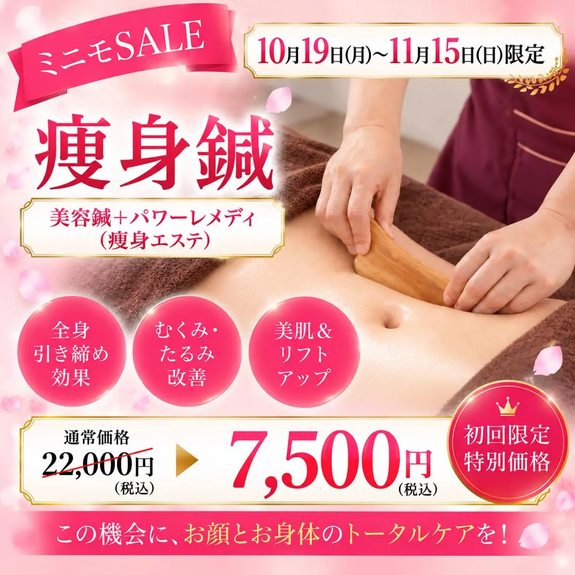 10/19​〜​11/15限定！人気No.3【痩身針】⭐️たるみケア＆痩身特化！美容鍼＋痩身エステの写真