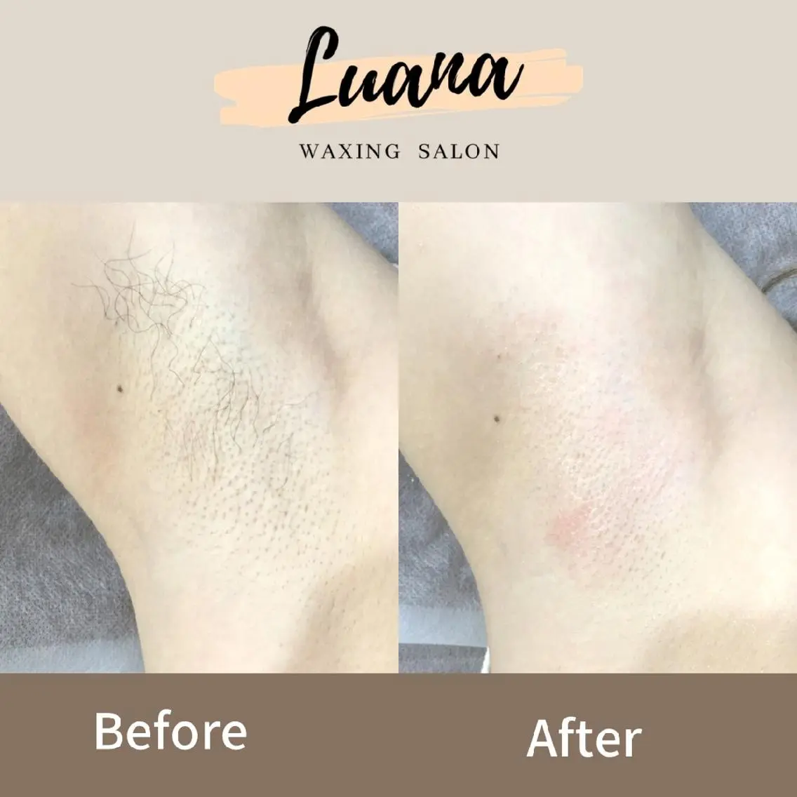 Luana wax 🐚根本のエステ・リラクイメージ