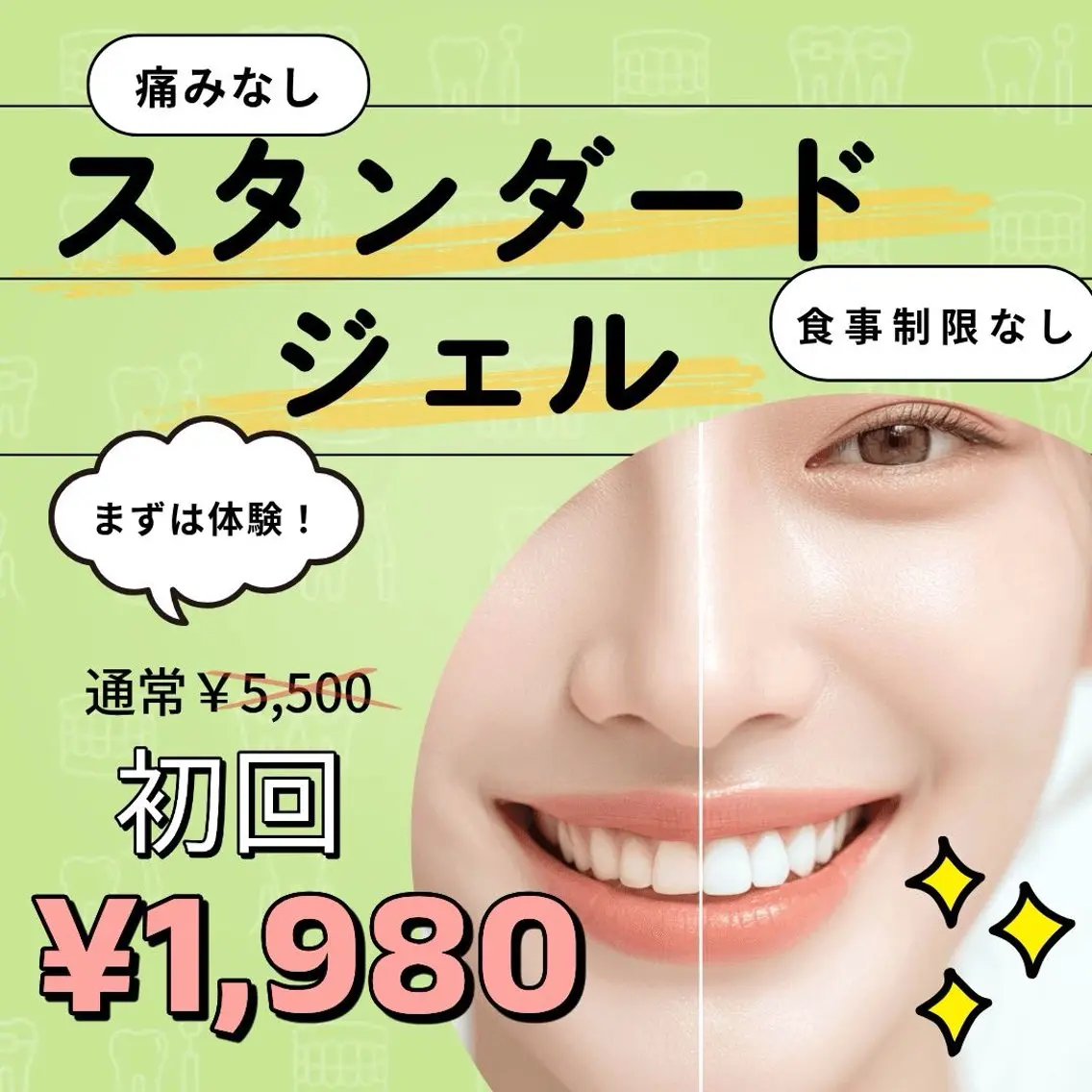 ミニモ限定★え!一回でこんな変わる??お試しセルフホワイトニング1回20分の写真