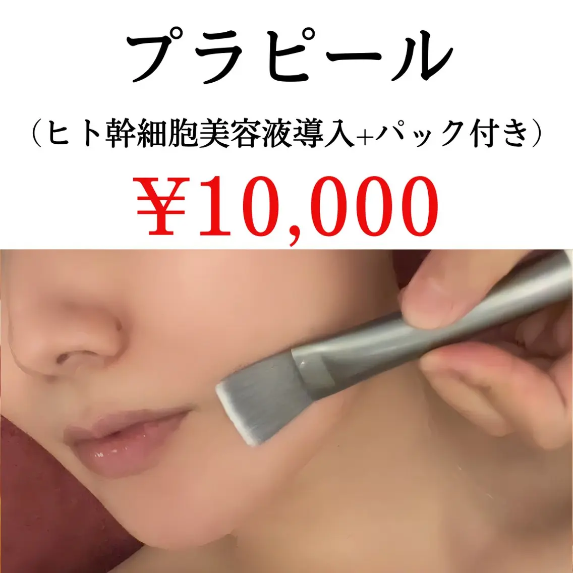 【初回】憧れの韓国アイドル肌☆第5世代ピーリング🫧プラピール★10,000円/ヒト幹導入&パック付き♪の写真