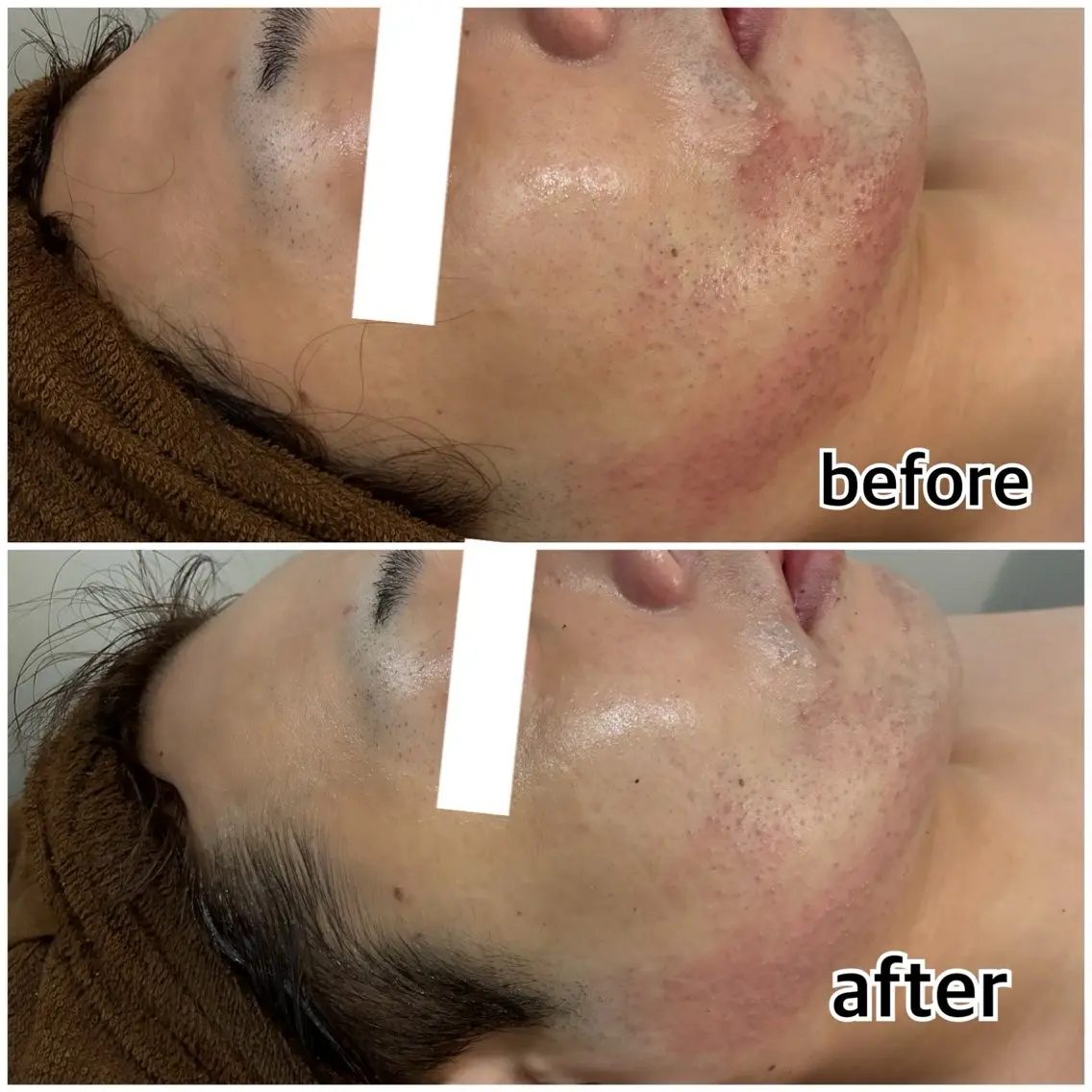 陶肌トリートメント【顔】の写真