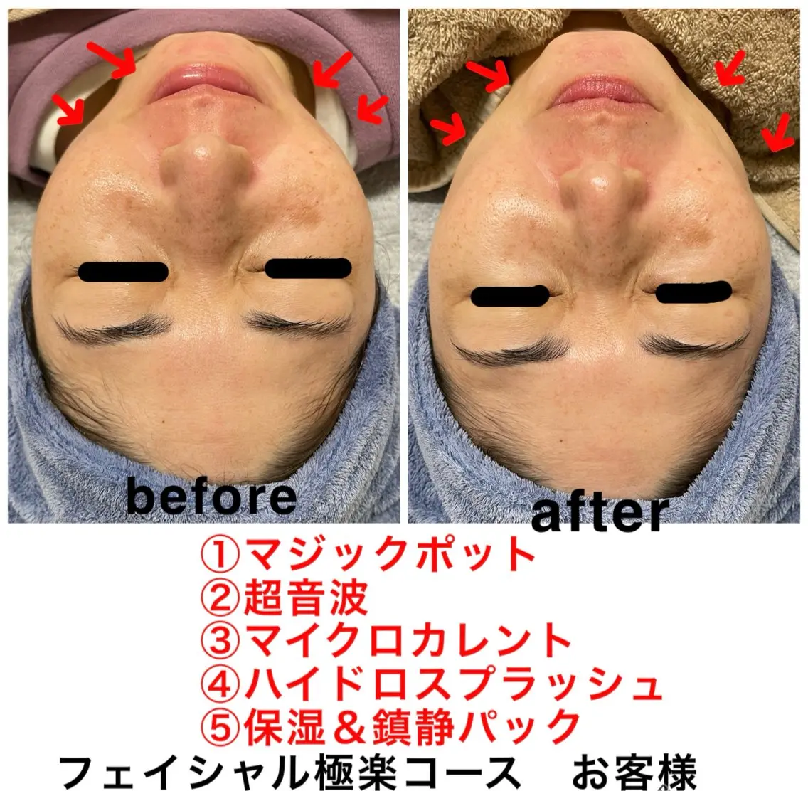 ネイル・エステサロン UILANIのエステ・リラクイメージ