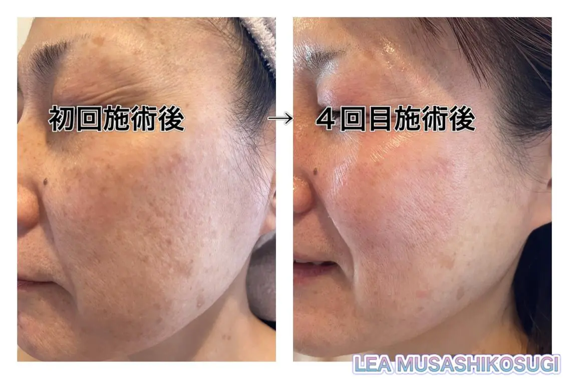 美肌育成サロン LEA武蔵小杉のエステ・リラクイメージ