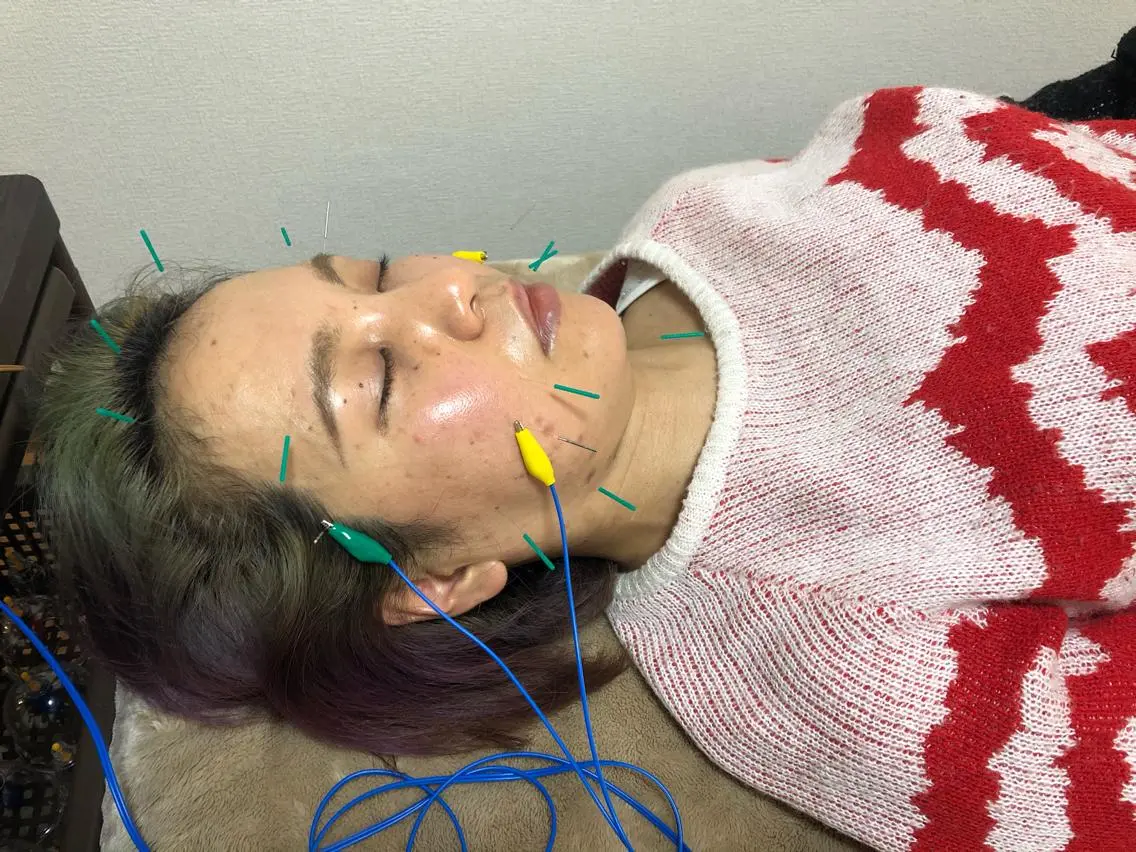 やはた 鍼灸整骨院のエステ・リラクイメージ