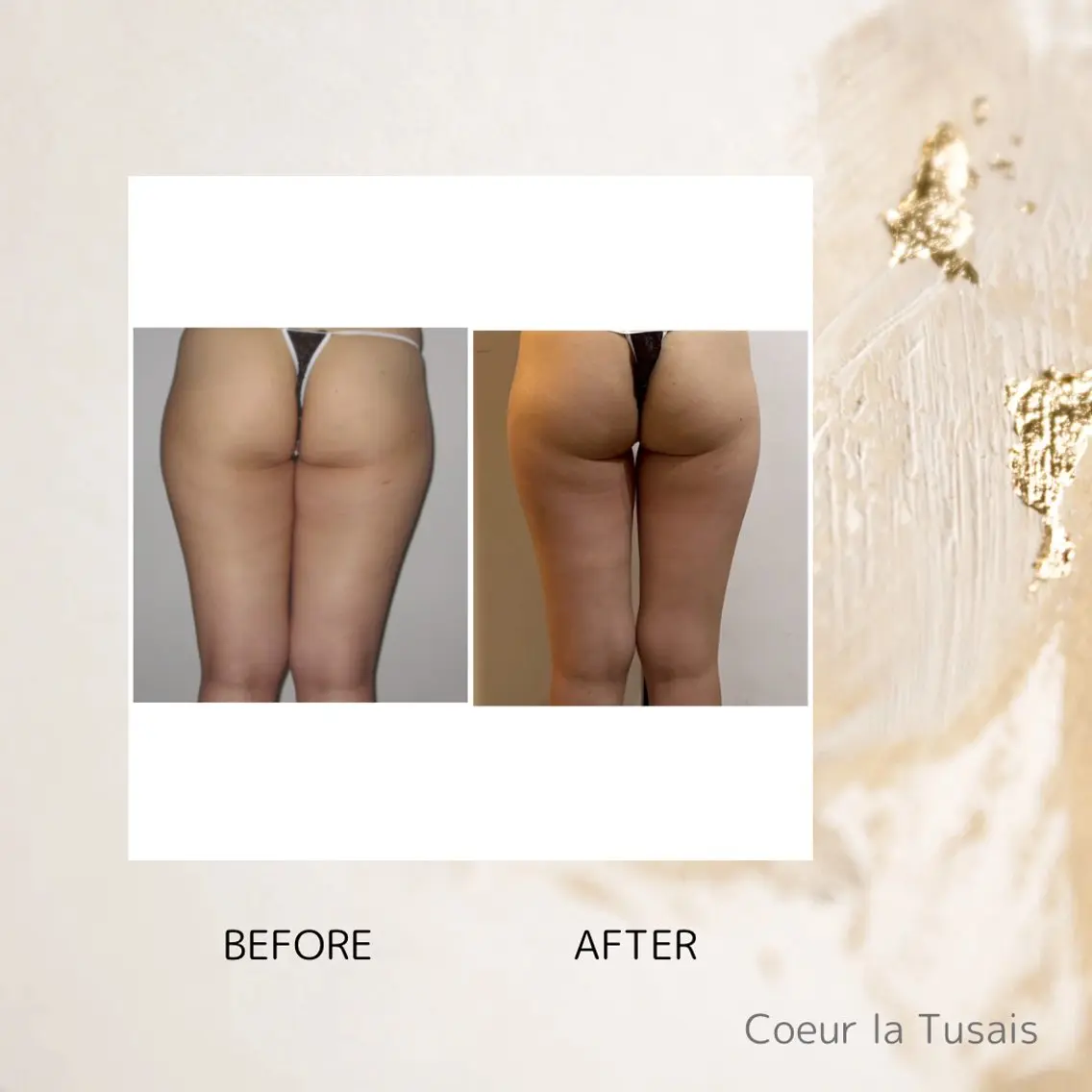 ヒップアップコースの写真