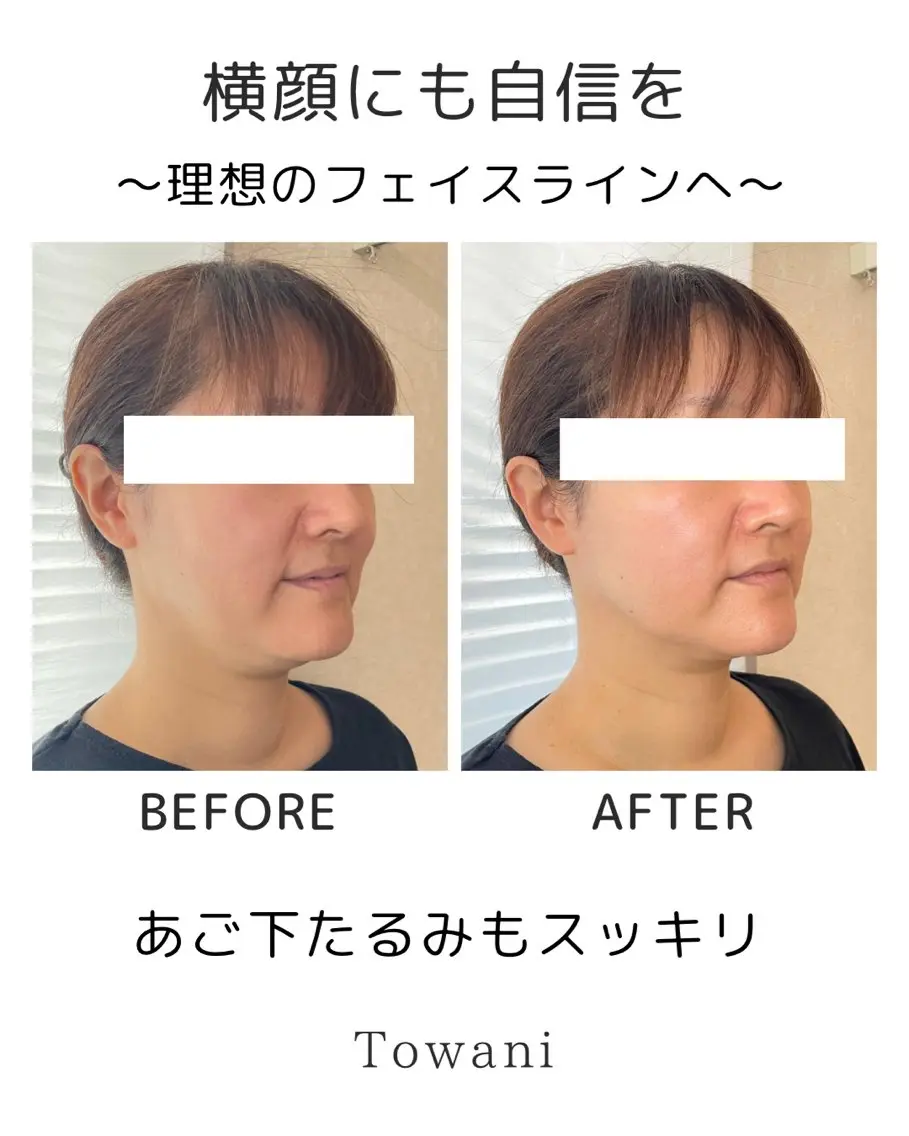 Towani 小顔・ビタミンケアのエステ・リラクイメージ