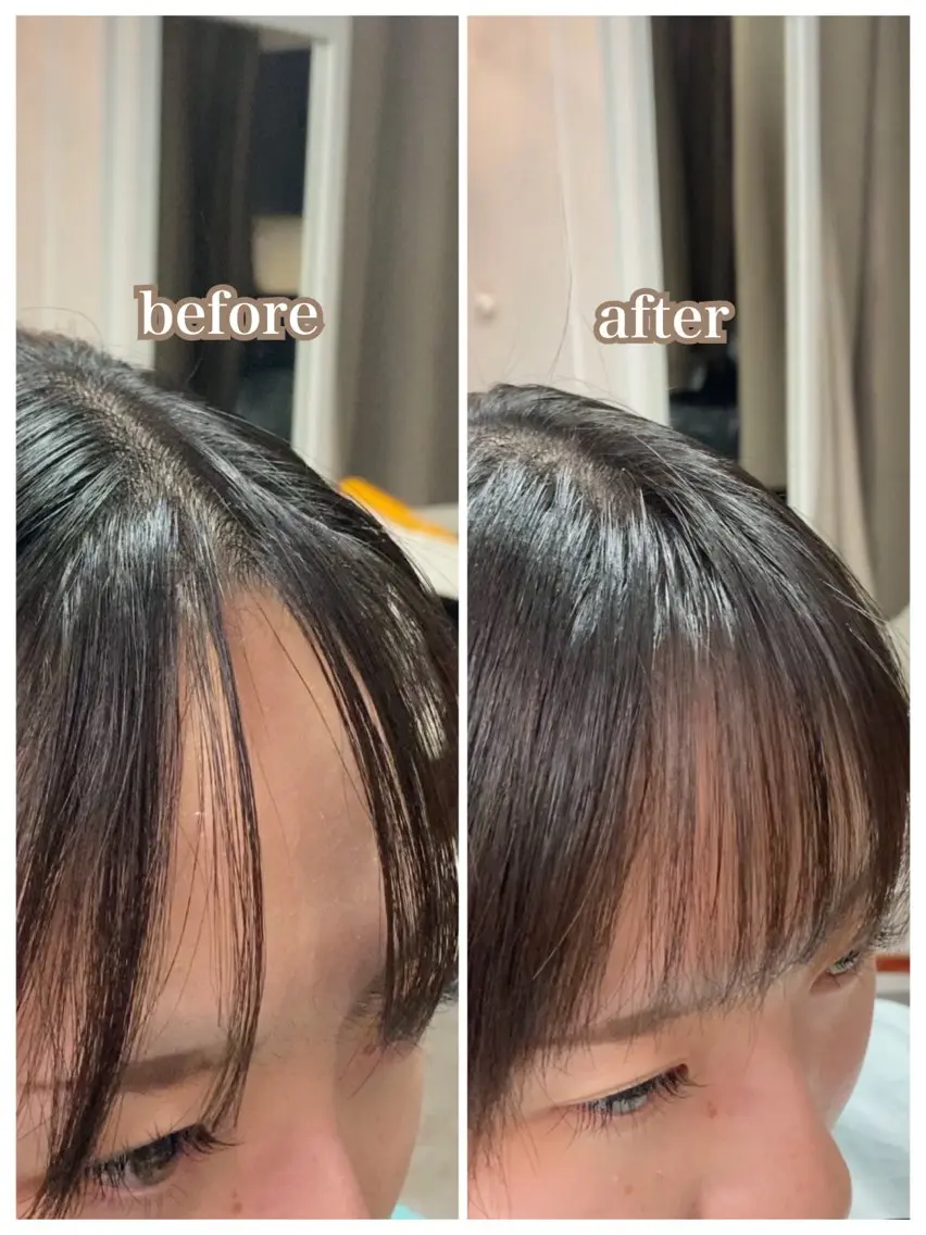 前髪ヘアリセッターの写真