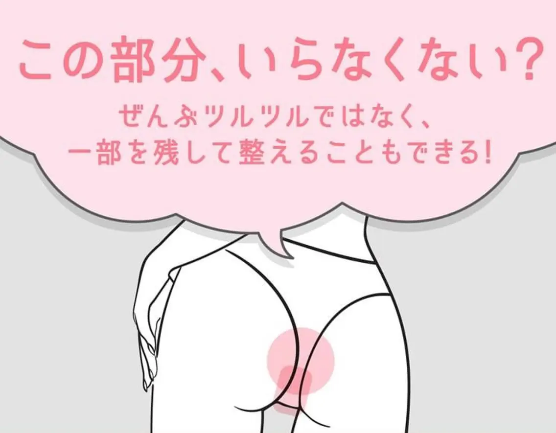 🌼VIO脱毛🌼1回券【🌸女性メニュー】の写真