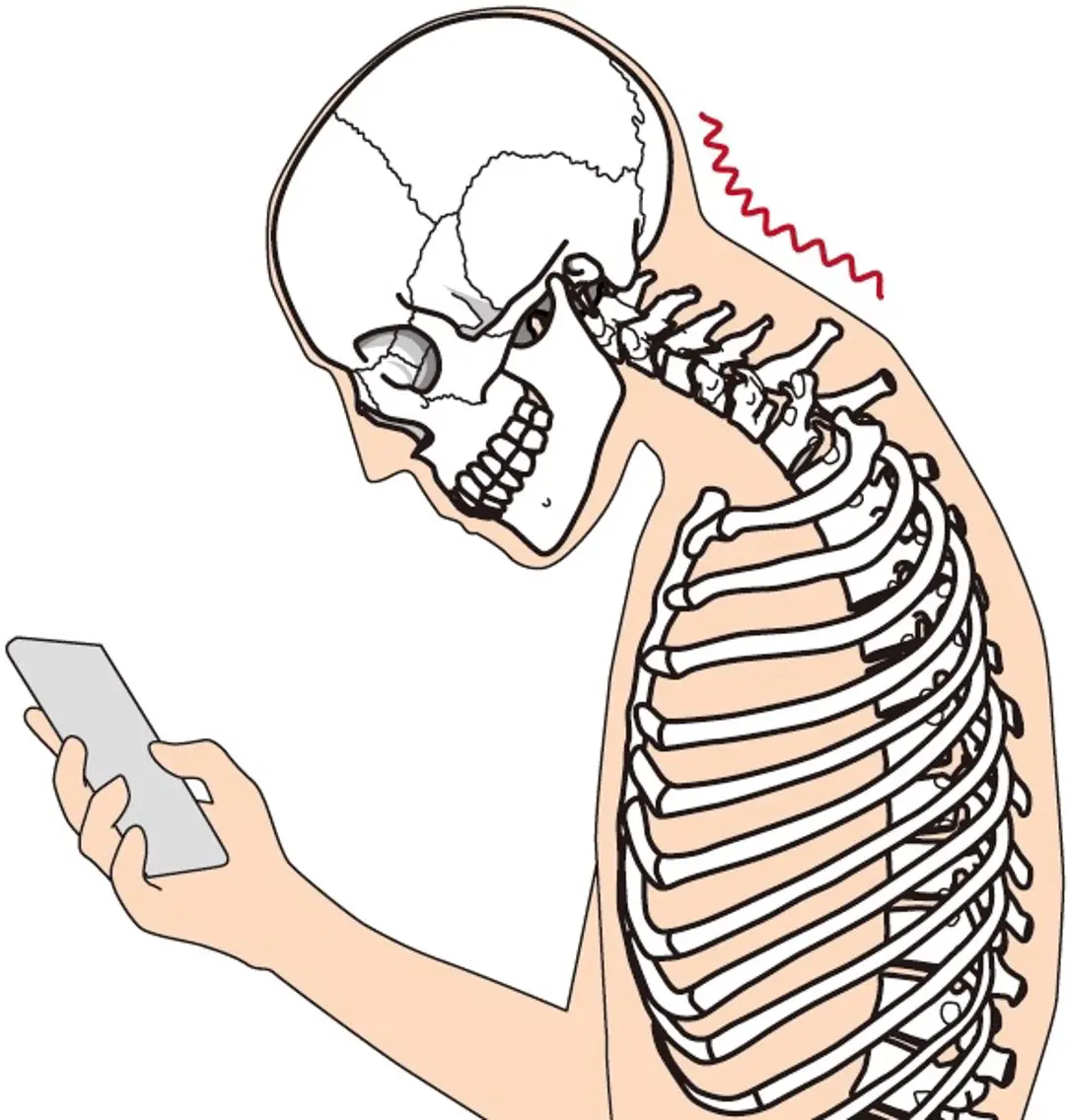 【猫背、スマホ首】見た目年齢は姿勢で変わる！スマホ首、猫背などが気になる方へ！美姿勢で人生が変わる✨の写真