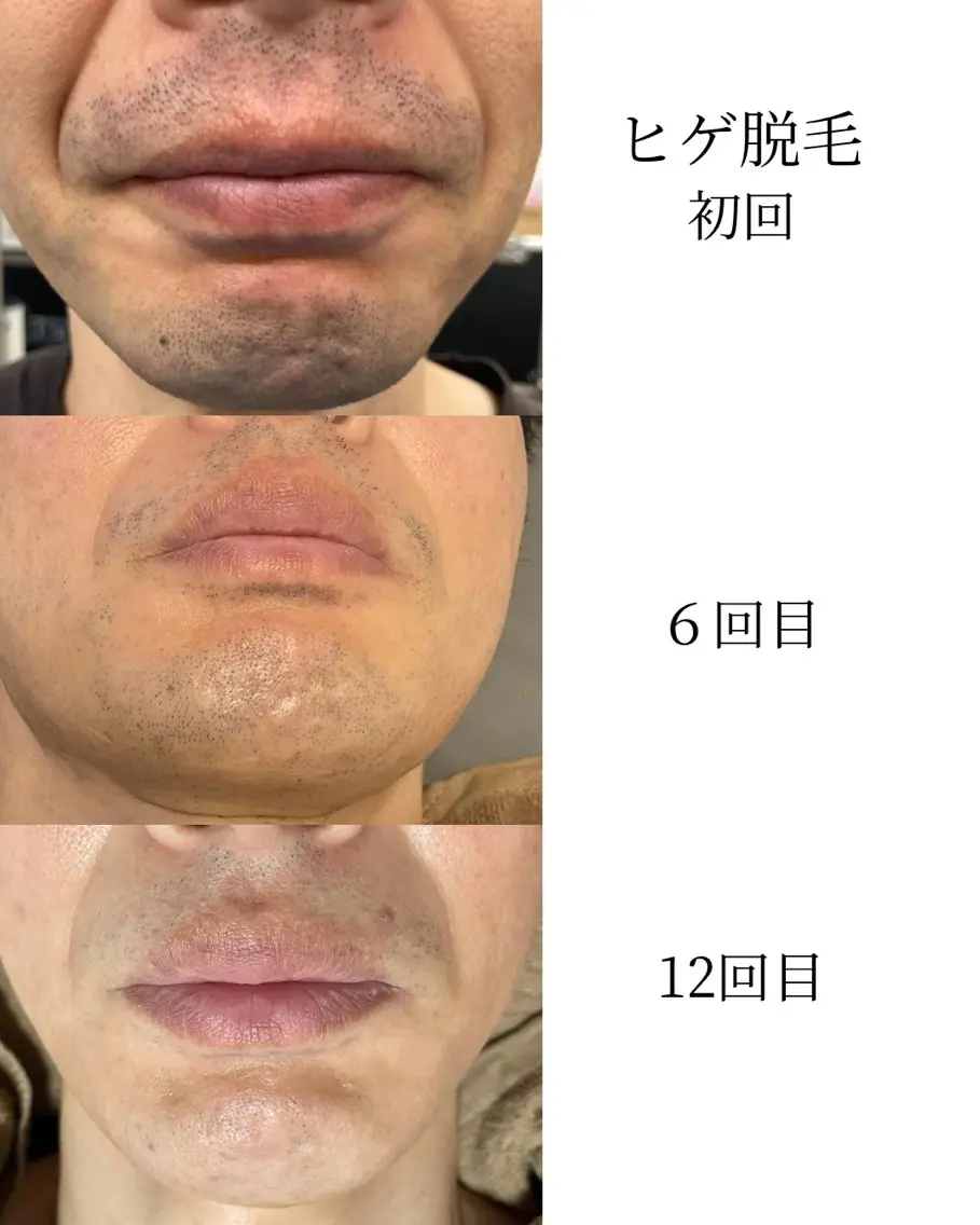 メンズ 脱毛 ビューティーサロン ベクスト名古屋のエステ・リラクイメージ