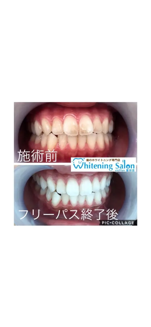 ホワイトニングサロン シフォン豊田店のエステ・リラクイメージ