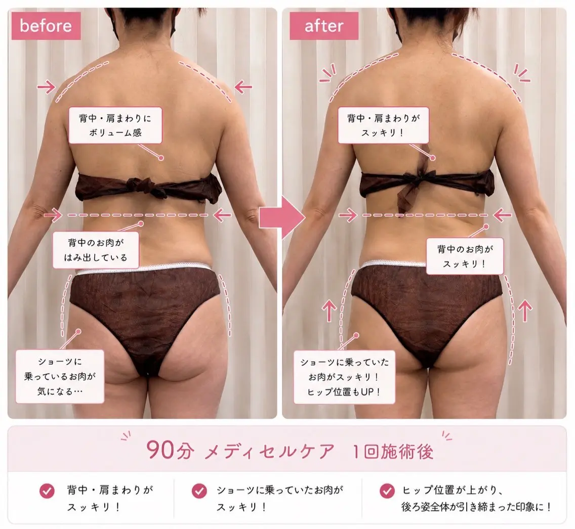 エステ 上石神井🌈美容整体 産後/井沢のエステ・リラクイメージ