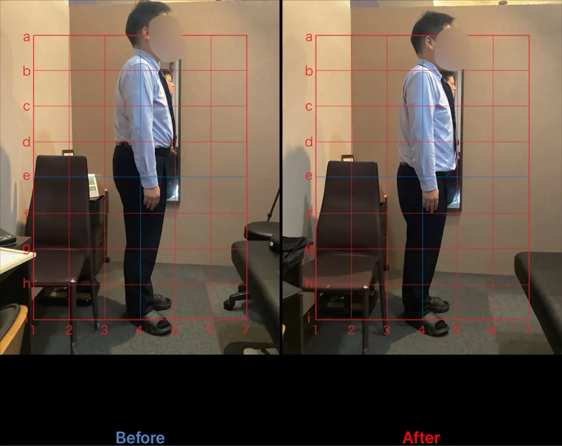 【腰痛再発防止】カイロプラクティック×整体の写真