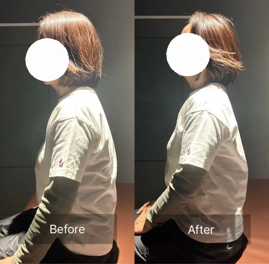 【トータルケア】美容鍼×整体プレミアム★90分¥15,000→¥10,000の写真